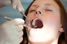 close-up of woman getting her teeth cleaned
