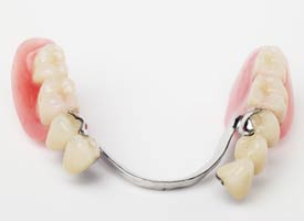 partial denture